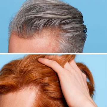 Anti-Hair Loss Duo
