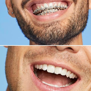 Kit Brosse à Dents + Dentifrice