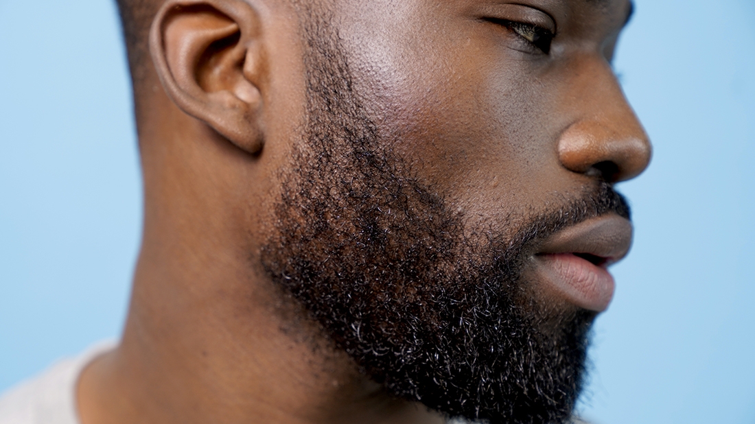 Where should your beard stop?